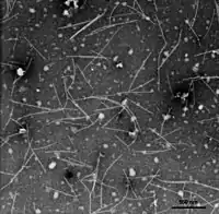 EM-Aufnahme von Virionen des Narzissen-Mosaikvirus (NMV)