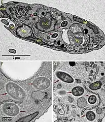 TEM-Aufnahmen von Ca. Bc. vickermanii in B. saltans