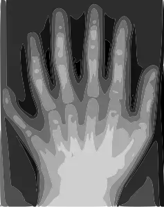 Vektorisiert 2006 mit Potrace in Inkscape zu einem achtfarbigen SVG-Bild (50&nbsp;KB)