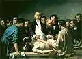 Leçon d’anatomie du docteur Velpeau