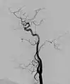 Angiogramm
