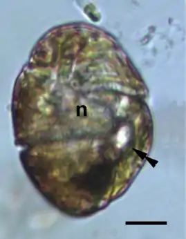 Lichtmikroskop-Aufnahme einer Zelle, durchscheinend braun, mit heller gefärbtem Zellkern in der Mitte und Ocelloid, bestehend aus einem hellen Bereich (Hyalosom, d. h. Linse) neben einem dunklen Bereich (Netzhautkörper).