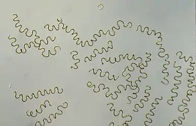 Anabaena circinalis