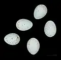 Eier des Taigabirkenzeisigs (Acanthis flammea flammea)
