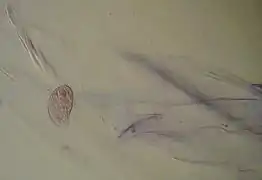 Wimpertierchen (Colpoda sp.) und Zwiebelhaut