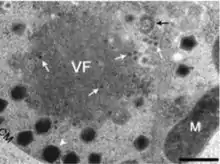 CroV repliziert in einer Virusfabrik (VF). Die weiße Pfeilspitze zeigt neu gebildete CroV-Partikel an. Es liegt eine Koinfektion mit dem Virophagen Mavirus vor, die weißen langstieligen Pfeile zeigen dessen kleine Partikel an.
