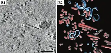 Lange gefüllte Tubuli (fTu) und von Membranen umhüllte Virionencluster. Balken 500&nbsp;nm
