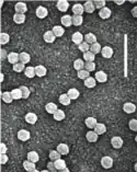 EM-Aufnahme von Virionen des Gelbverzwergungsvirus PAV (BYDV-PAV)