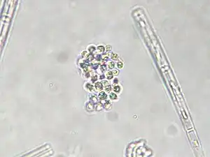 Gomphosphaeria sp., eine Blaualge, wie sie laut Kann unter anderem auch im Lunzer See vorkommt, aber (wegen Merkmalsarmut) kaum näher zu bestimmen war.