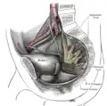 Dissektion der Seitenwand des Beckens mit dem Plexus lumbosacralis.