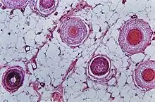 Der histologische Schrägschnitt der menschlichen Kopfhaut zeigt in unterschiedlicher Höhe angeschnittene Haarfollikel (Hämatoxylin-Eosin-Färbung)