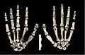 Handknochen