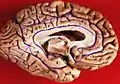 Ansicht von medial (Gyrus parahippocampalis mit „5“ gekennzeichnet)
