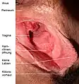 Blick auf das (intravaginal) sichtbare periurethale Schwellkörpergewebe. Die Eichel der Klitoris liegt zum Bildunterrand. Darüber die Harnröhrenmündung (Meatus urethrae externus) sie ist geschlossen und als kleine Erhebung sichtbar.