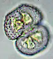 Cosmarium vexatum
