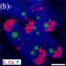 Die EDXS-Elementkarte zeigt Anordnung von Karbonat- (rote Farben) und Polyphosphat-Einschlüssen (grüne Farben). Balken 1 µm.