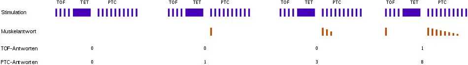 Post tetanic count