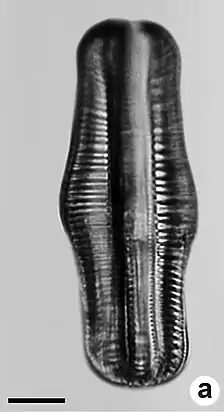 R. gibba vom Einzugsgebiet des Río Cali (englisch Cali River), Kolumbien. Balken 10 µm.