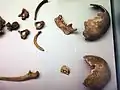 Fragmentarische Reste menschlicher Knochen