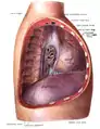 Mediastinum von rechtslateral