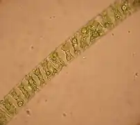 Spirogyra im Lichtmikroskop