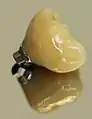 Verschraubte Implantatkrone mittels CEREC hergestellt