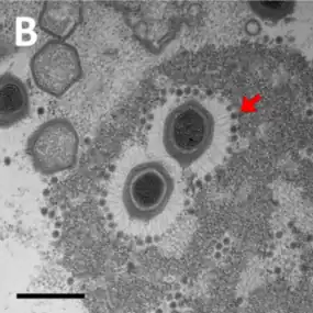 TEM-Aufnahme von Sputnik-Virionen, die an Mimivirus-Fibrillen gebunden sind. (Balken 500&nbsp;nm).