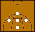 1-3-1-Zone