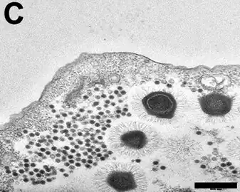 TEM-Aufnahme eines Dünnschnitts von „Sputnik&nbsp;3“-Virophagen in einer Kultur mit Mimiviren. Balken 500&nbsp;nm.