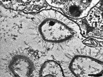 „Sputnik&nbsp;3“-Virophagen, produziert in einer VF von Moumouvirus (Gruppe-B-Mimiviren). Balken 200&nbsp;nm.
